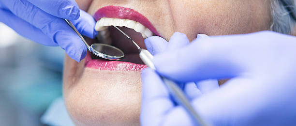 Best Emergency Gum Treatment in Mountain Home, ID